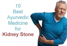 Ayurvedic Medicine for Kidney Stone